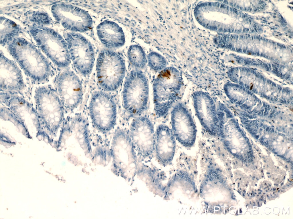 Immunohistochemistry (IHC) staining of human colon tissue using peptide YY Polyclonal antibody (24294-1-AP)