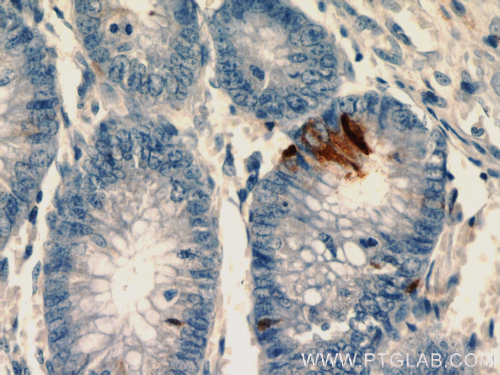 Immunohistochemistry (IHC) staining of human colon tissue using peptide YY Polyclonal antibody (24294-1-AP)