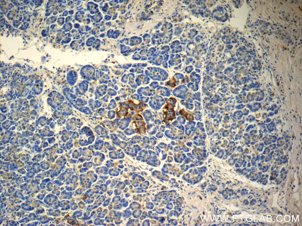 Immunohistochemistry (IHC) staining of human pancreas tissue using peptide YY Polyclonal antibody (24294-1-AP)