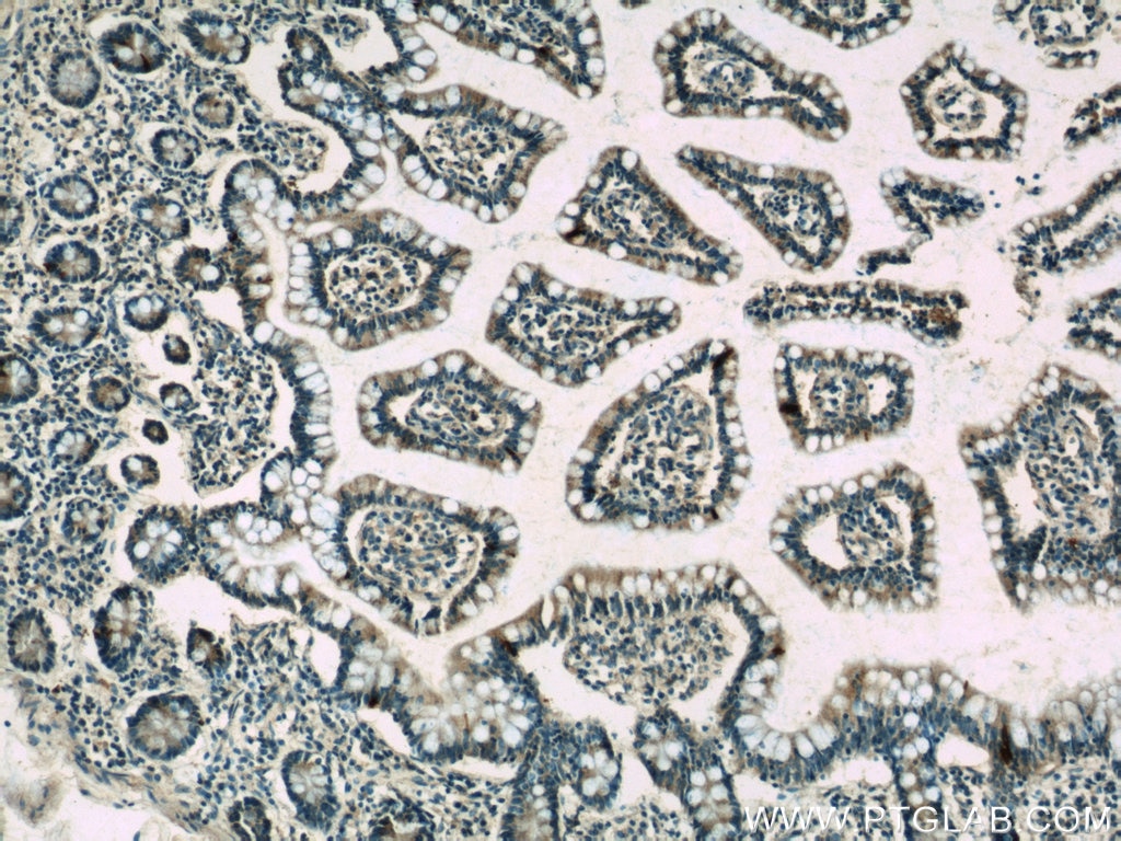 Immunohistochemistry (IHC) staining of human small intestine tissue using peptide YY Polyclonal antibody (24294-1-AP)