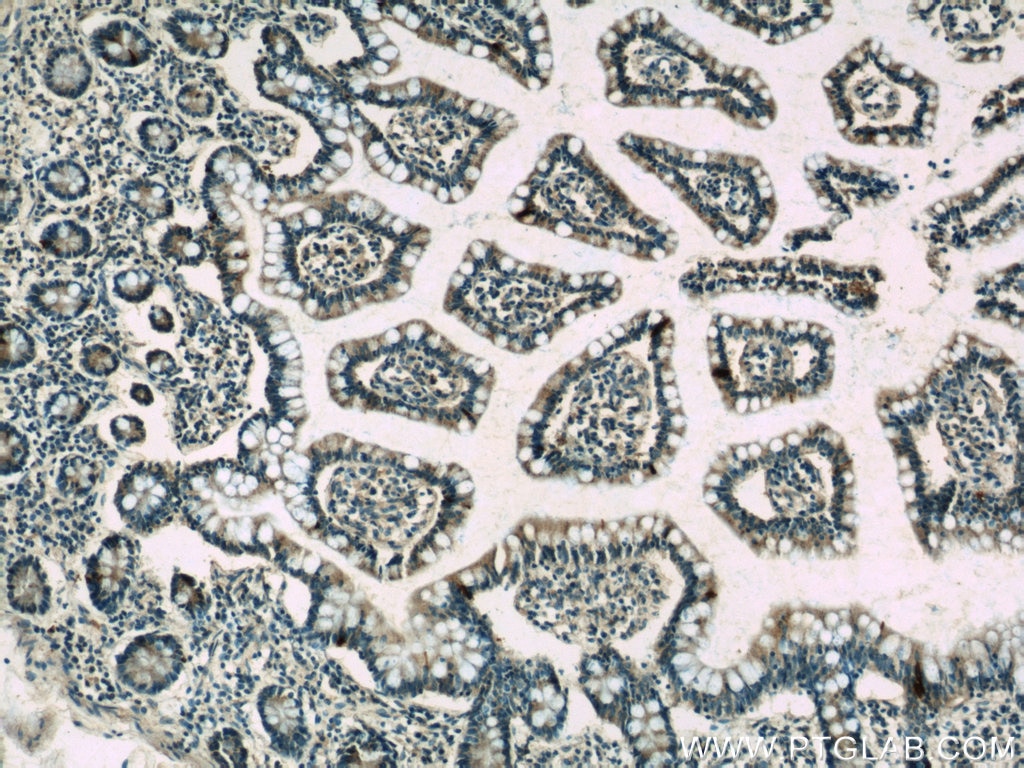 IHC staining of human small intestine using 24294-1-AP