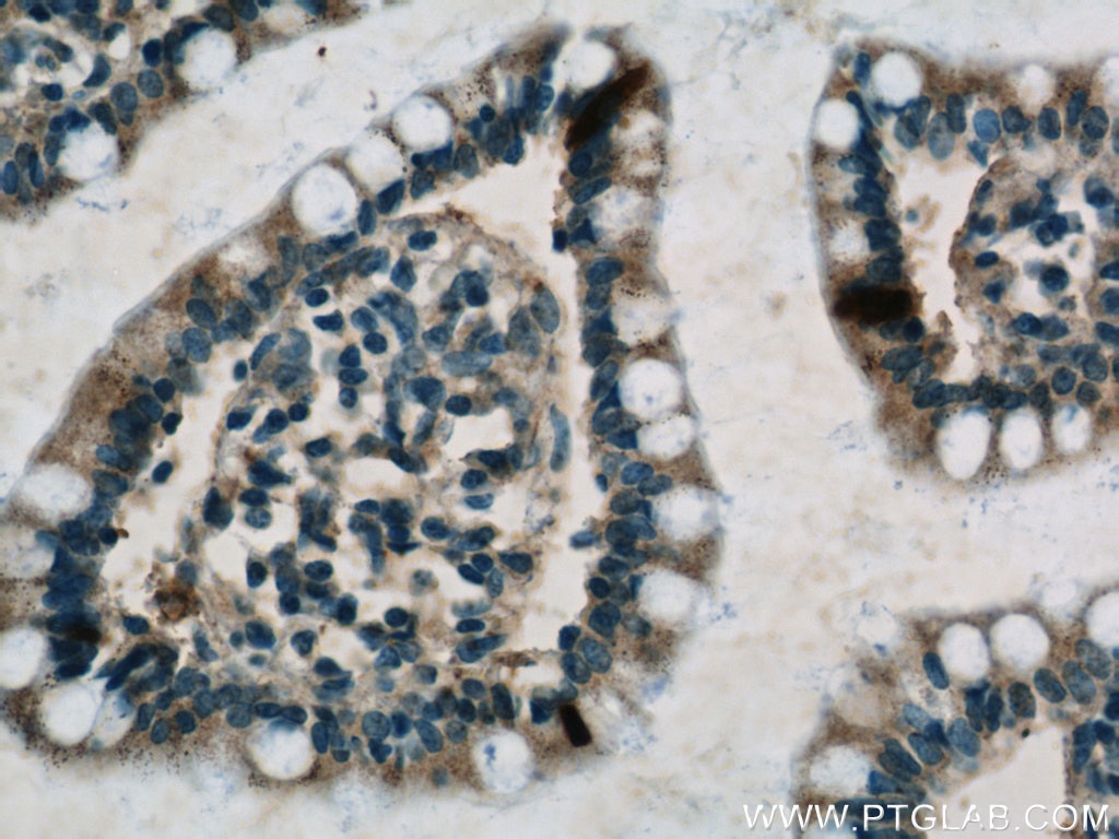 Immunohistochemistry (IHC) staining of human small intestine tissue using peptide YY Polyclonal antibody (24294-1-AP)