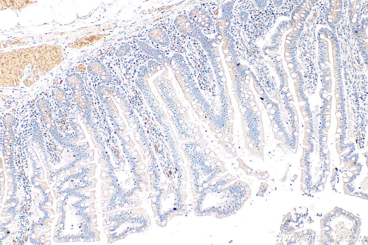 Immunohistochemistry (IHC) staining of human small intestine tissue using peptide YY Polyclonal antibody (24294-1-AP)