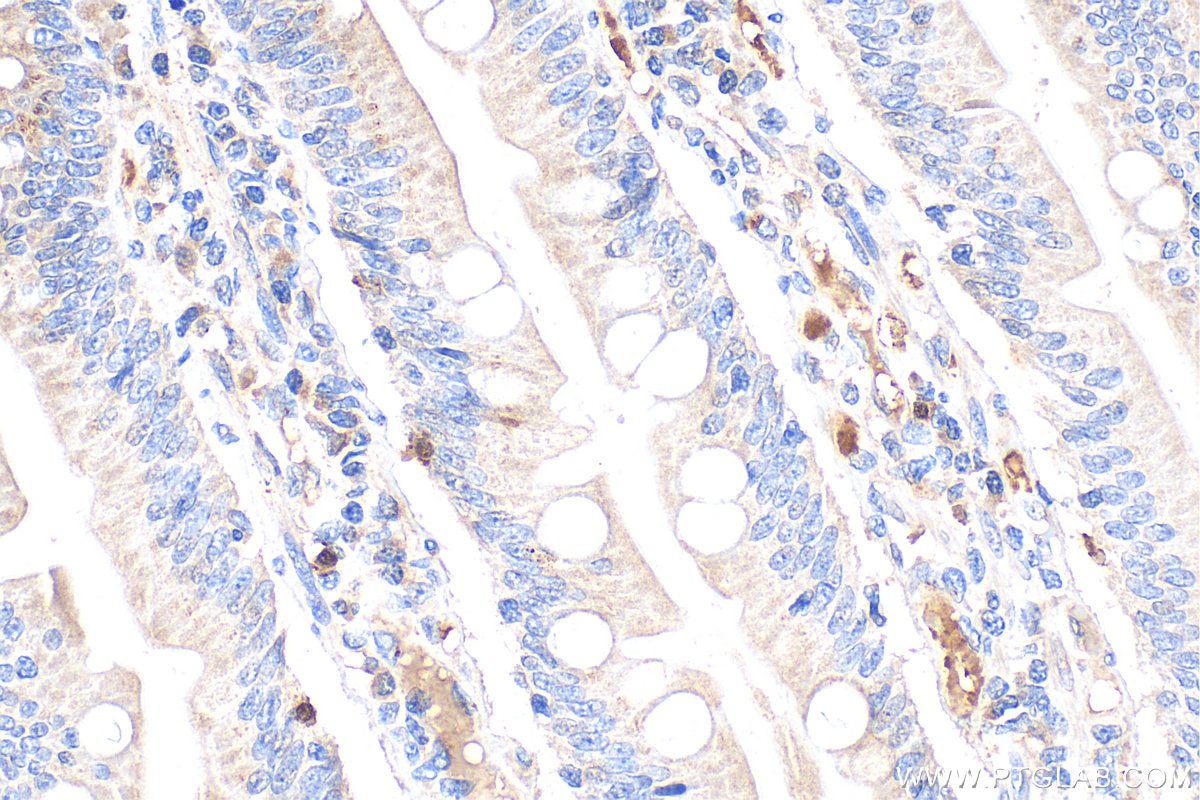 Immunohistochemistry (IHC) staining of human small intestine tissue using peptide YY Polyclonal antibody (24294-1-AP)
