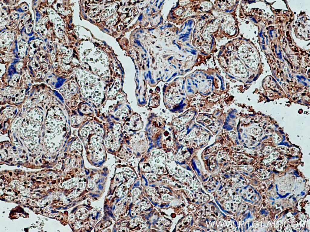 Immunohistochemistry (IHC) staining of human placenta tissue using pregnancy zone protein Polyclonal antibody (21742-1-AP)