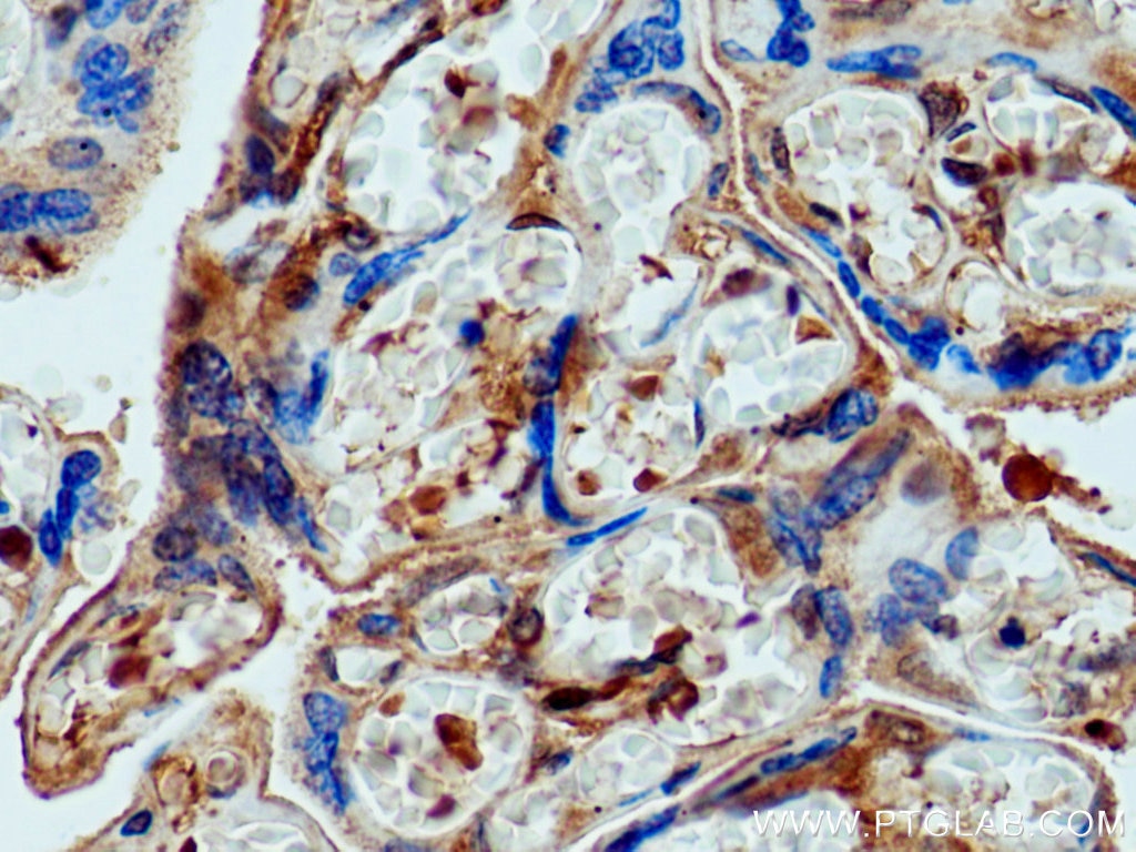 Immunohistochemistry (IHC) staining of human placenta tissue using pregnancy zone protein Polyclonal antibody (21742-1-AP)