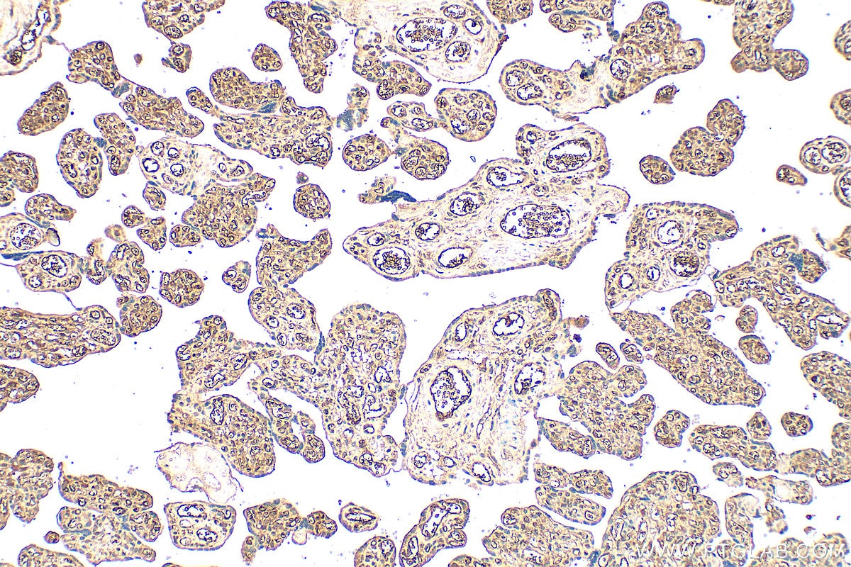 Immunohistochemistry (IHC) staining of human placenta tissue using Pregnancy Zone Protein Polyclonal antibody (21742-1-AP)
