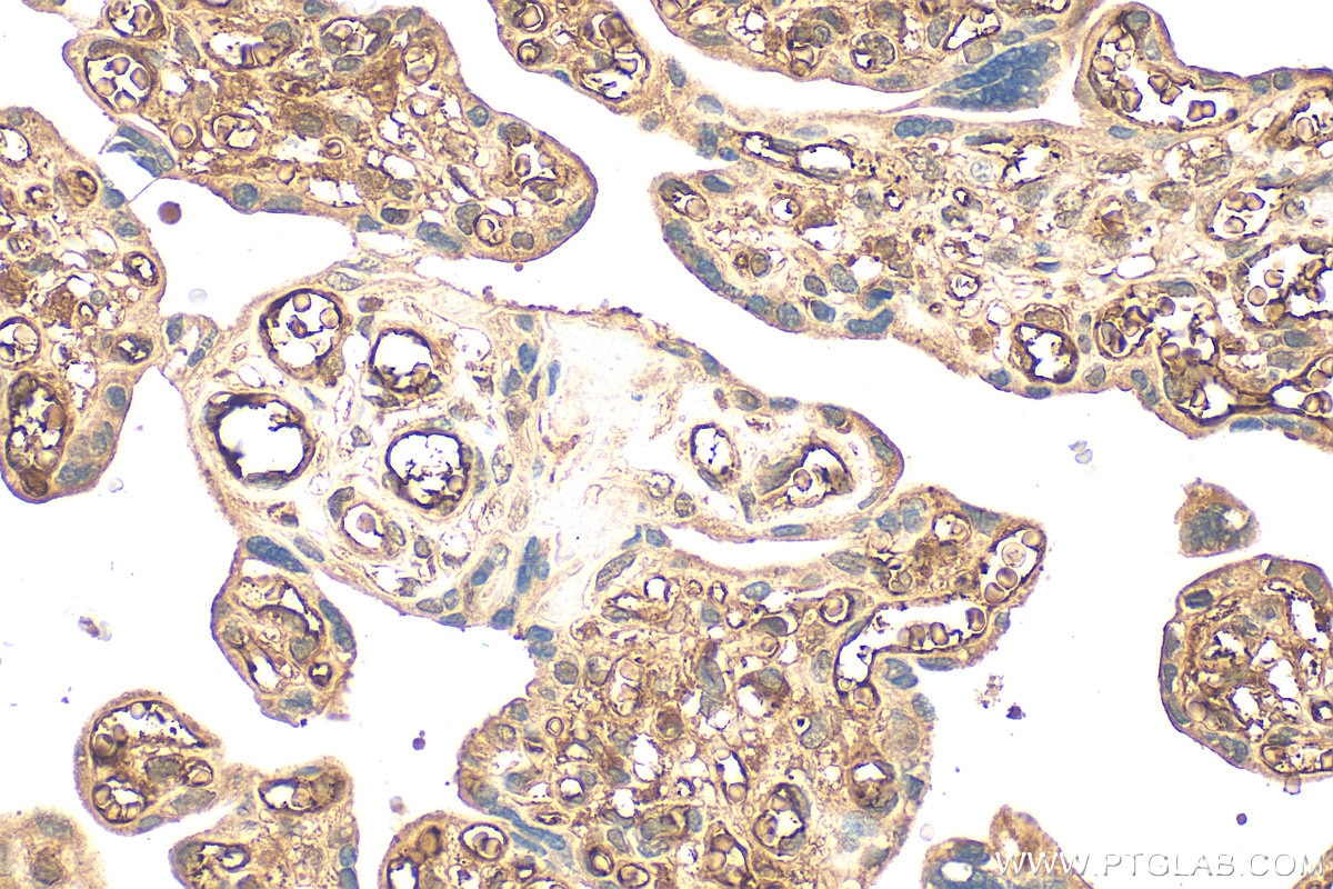 Immunohistochemistry (IHC) staining of human placenta tissue using Pregnancy Zone Protein Polyclonal antibody (21742-1-AP)