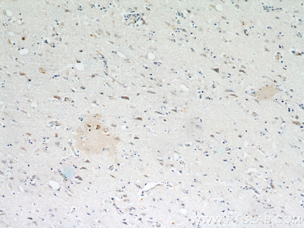 Immunohistochemistry (IHC) staining of human brain tissue using pregnancy zone protein Polyclonal antibody (21742-1-AP)