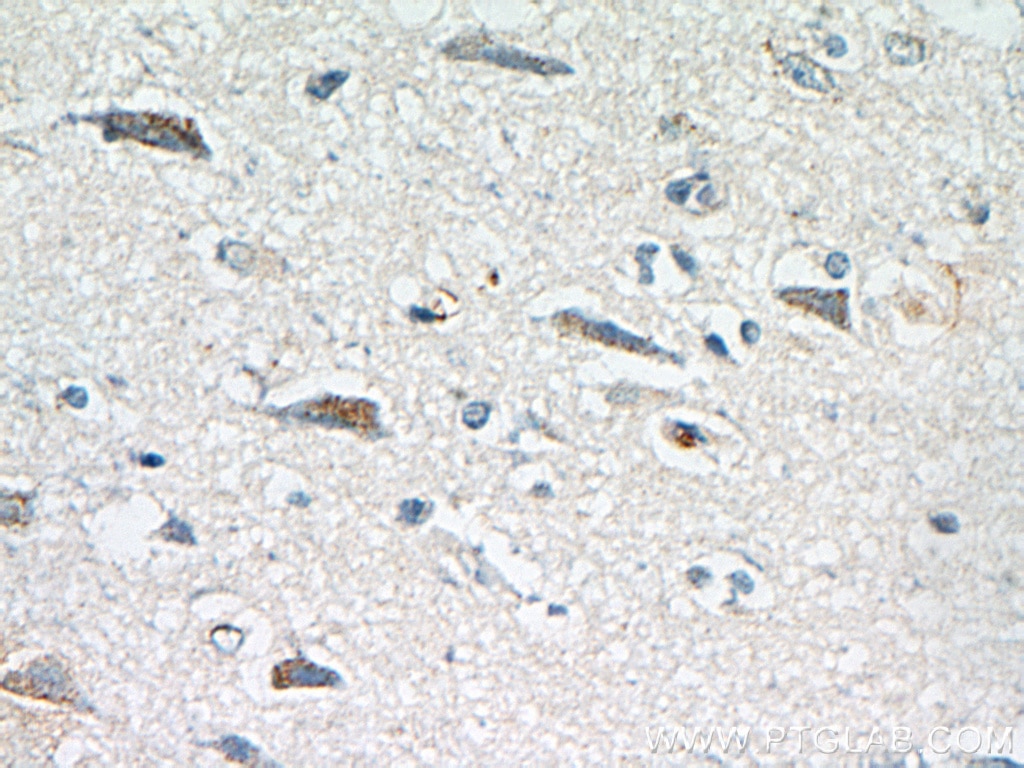 Immunohistochemistry (IHC) staining of human brain tissue using pregnancy zone protein Polyclonal antibody (21742-1-AP)