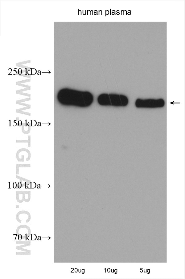 Western Blot (WB) analysis of various lysates using pregnancy zone protein Polyclonal antibody (21742-1-AP)