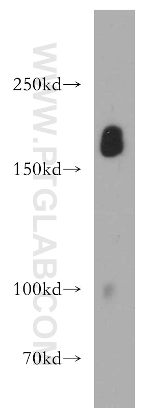 Western Blot (WB) analysis of human placenta tissue using pregnancy zone protein Polyclonal antibody (21742-1-AP)