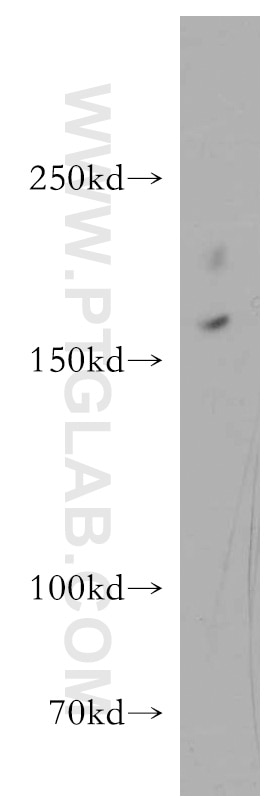 Western Blot (WB) analysis of human brain tissue using pregnancy zone protein Polyclonal antibody (21742-1-AP)