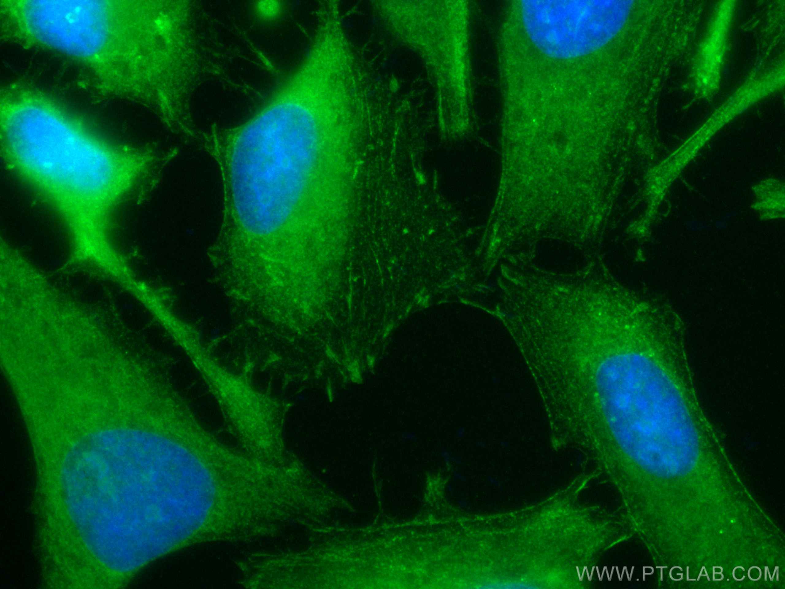 Immunofluorescence (IF) / fluorescent staining of HeLa cells using CoraLite® Plus 488-conjugated Palladin Polyclonal  (CL488-10853)