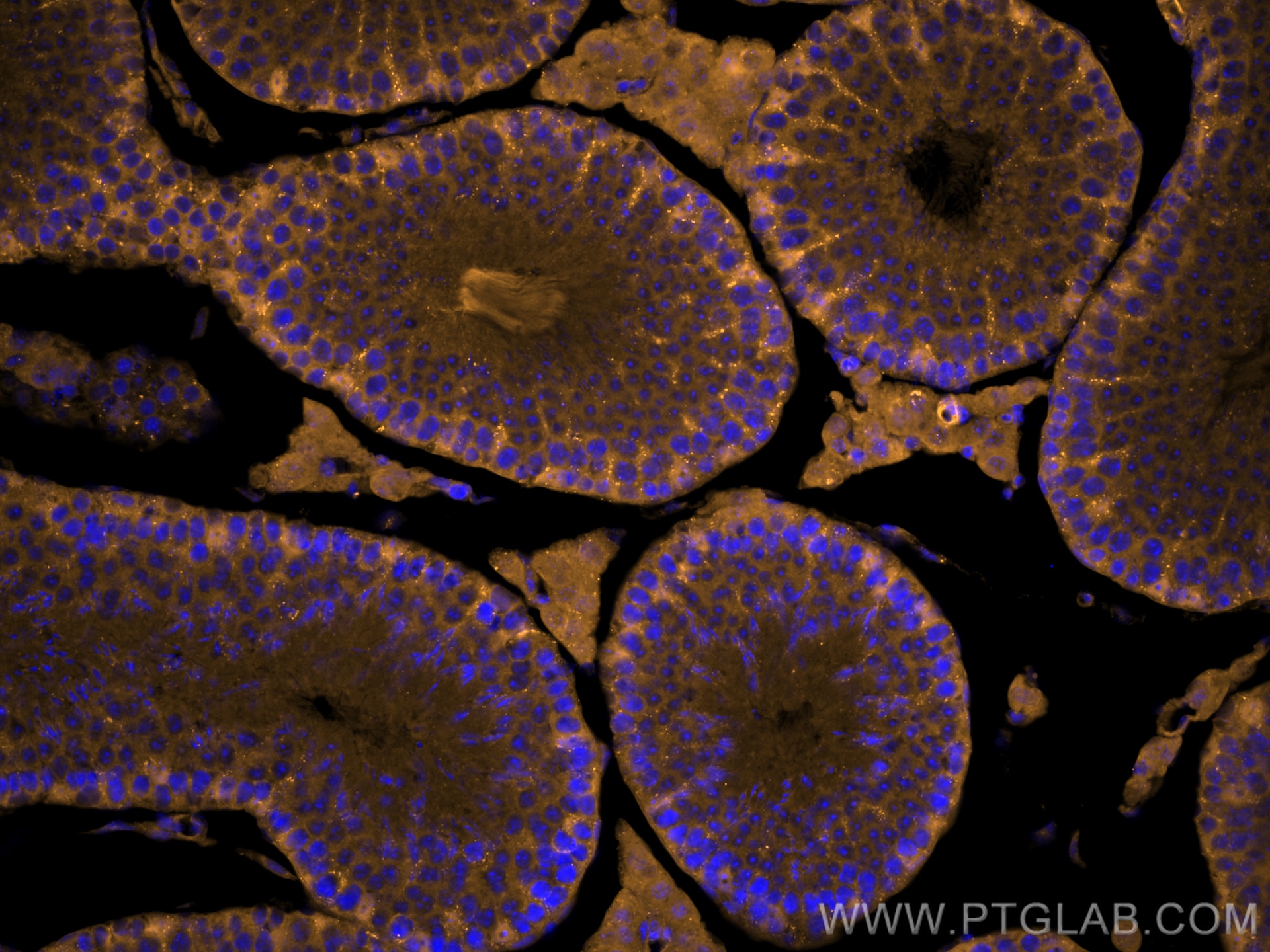 Immunofluorescence (IF) / fluorescent staining of mouse testis tissue using CoraLite®555-conjugated Palladin Polyclonal antibo (CL555-10853)