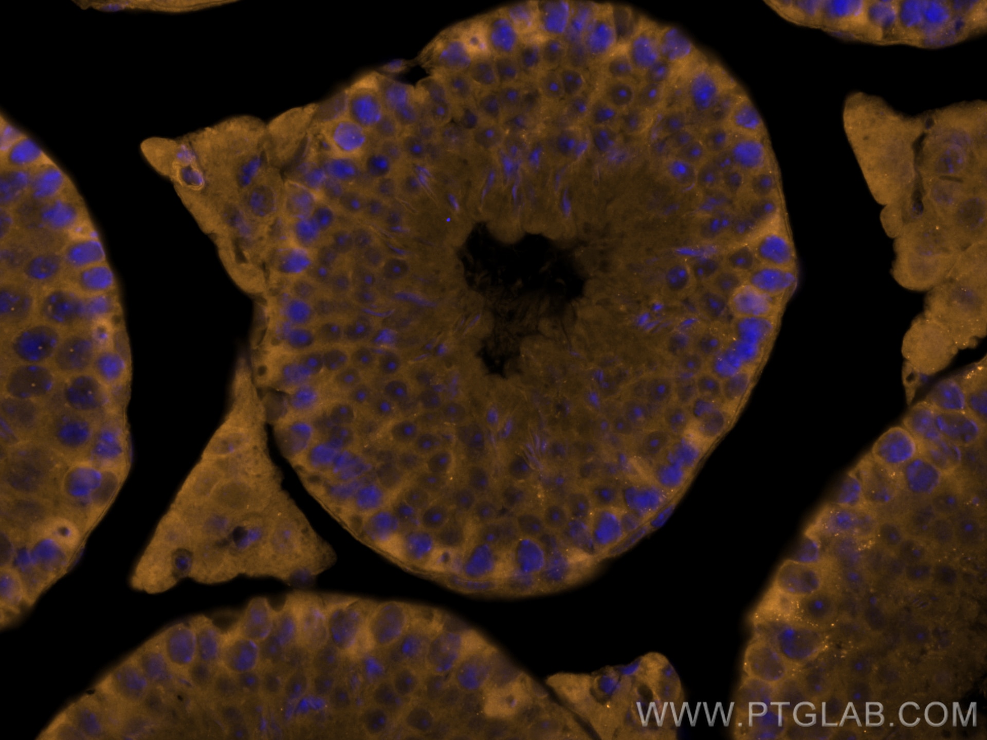 Immunofluorescence (IF) / fluorescent staining of mouse testis tissue using CoraLite®555-conjugated Palladin Polyclonal antibo (CL555-10853)