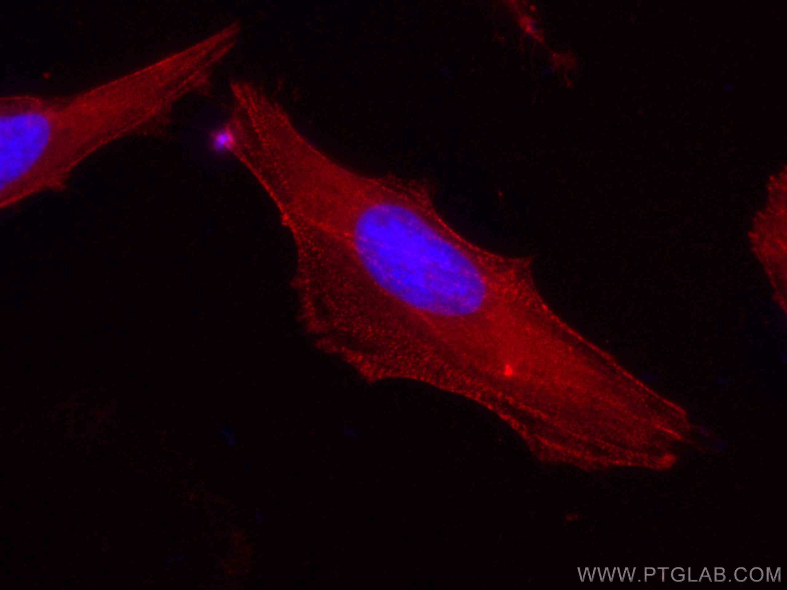 Immunofluorescence (IF) / fluorescent staining of HeLa cells using CoraLite®594-conjugated Palladin Polyclonal antibo (CL594-10853)