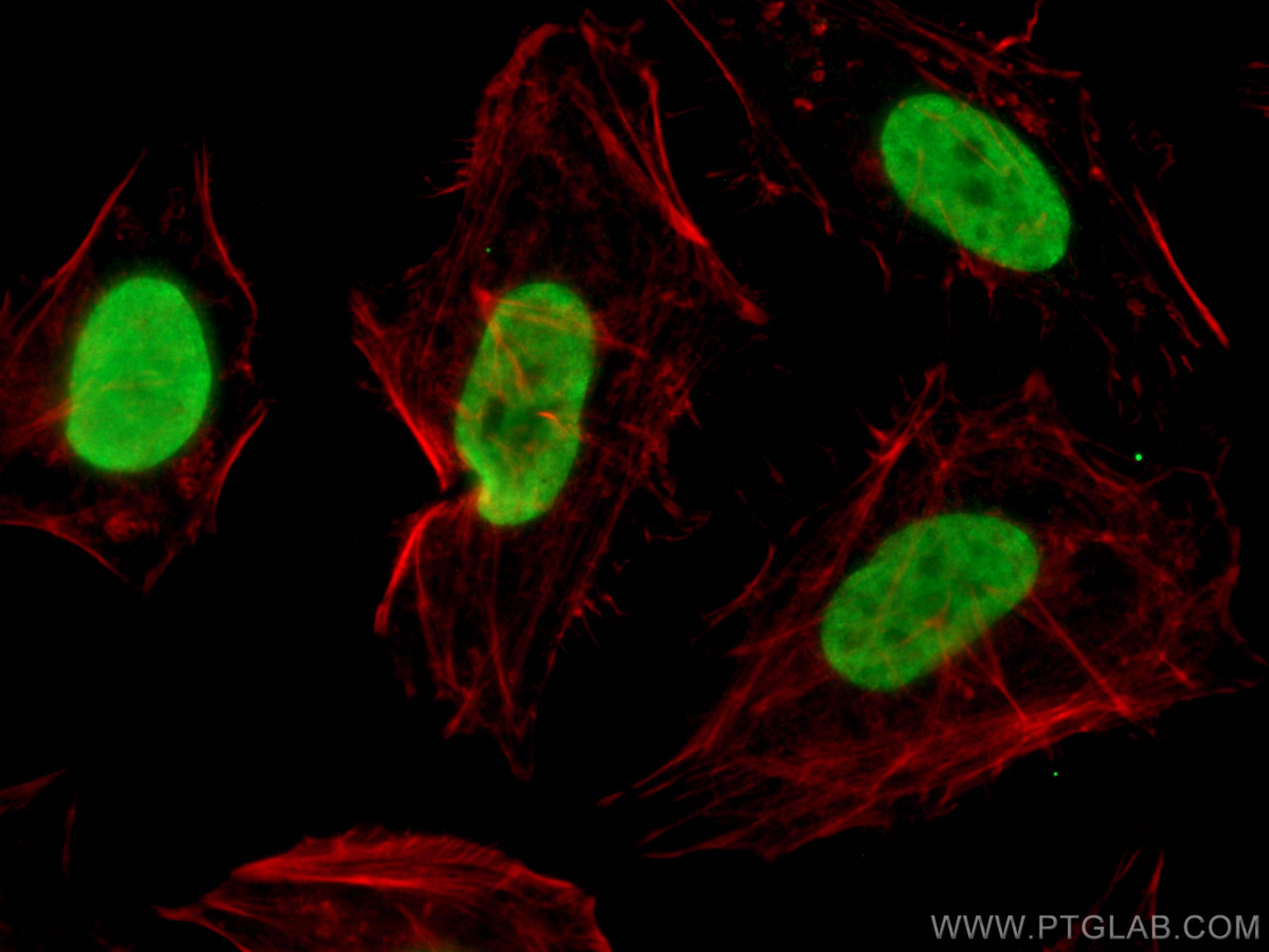 Immunofluorescence (IF) / fluorescent staining of HeLa cells using Pan Acetylation Monoclonal antibody (66289-1-Ig)