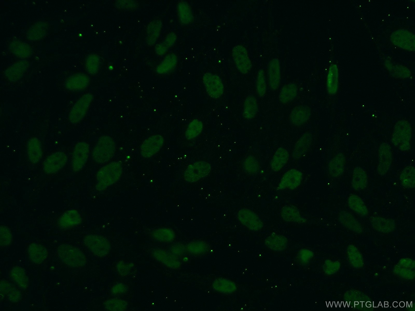 Immunofluorescence (IF) / fluorescent staining of MDCK cells using Pan Acetylation Monoclonal antibody (66289-1-Ig)