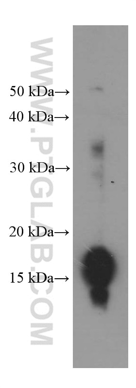 WB analysis of HeLa using 66289-1-Ig