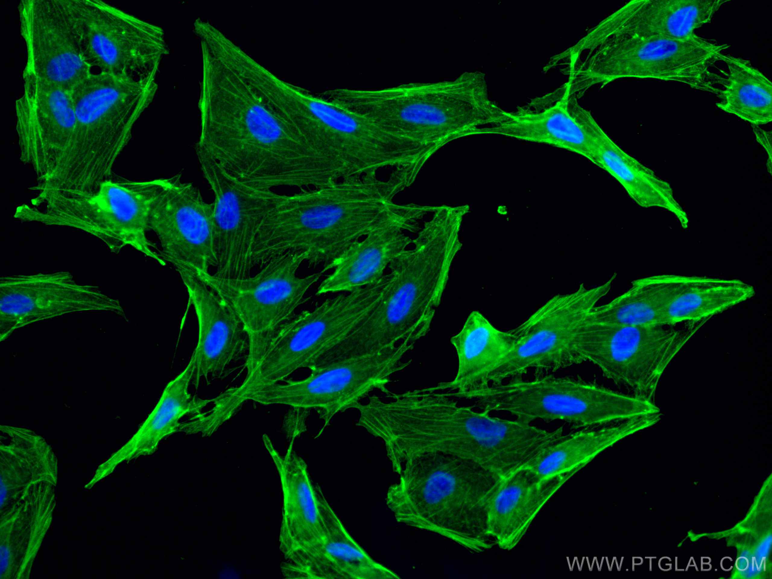 Immunofluorescence (IF) / fluorescent staining of MDCK cells using Beta Actin Monoclonal antibody (66009-1-Ig)
