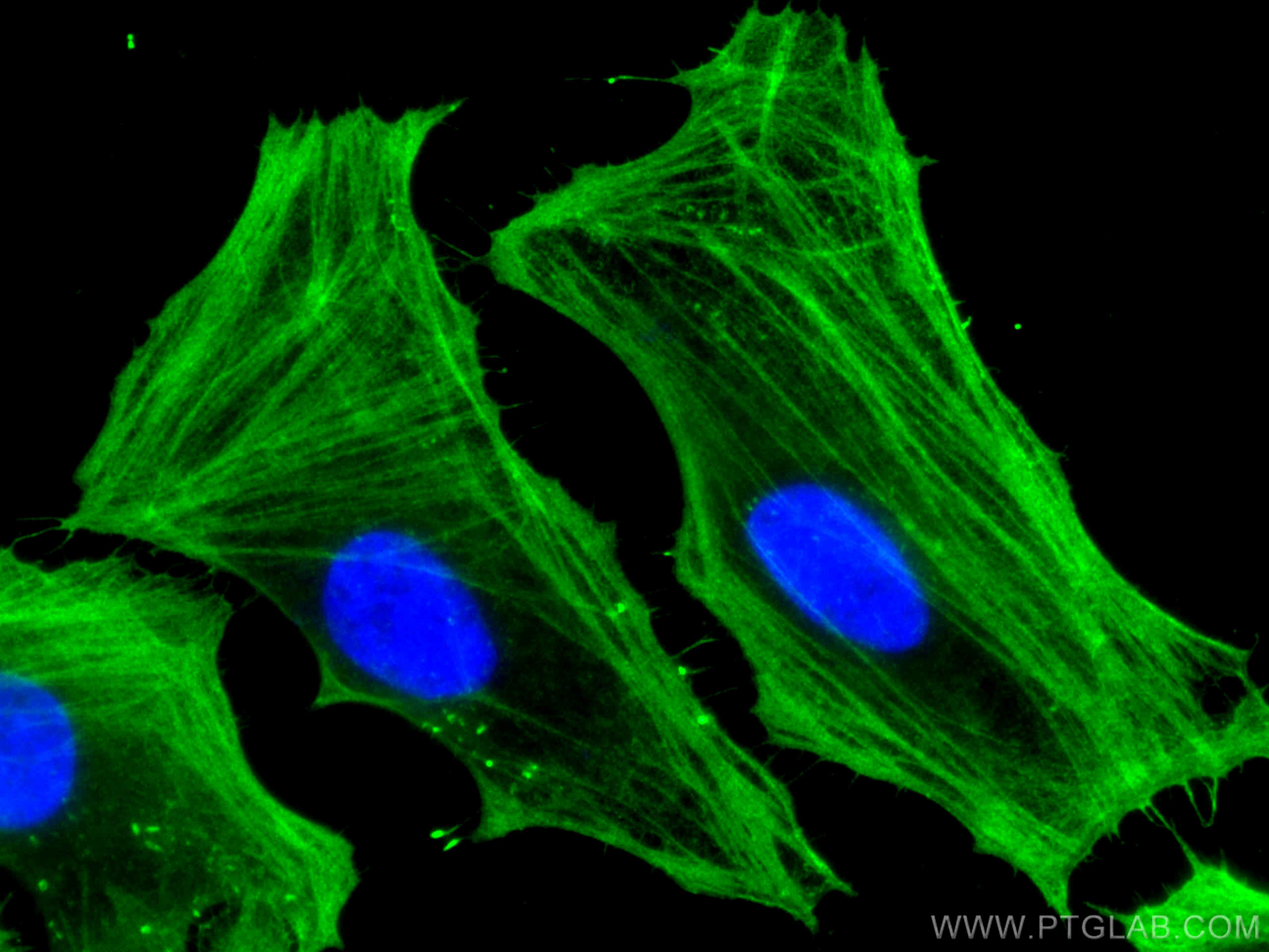 Immunofluorescence (IF) / fluorescent staining of HeLa cells using Beta Actin Monoclonal antibody (66009-1-Ig)