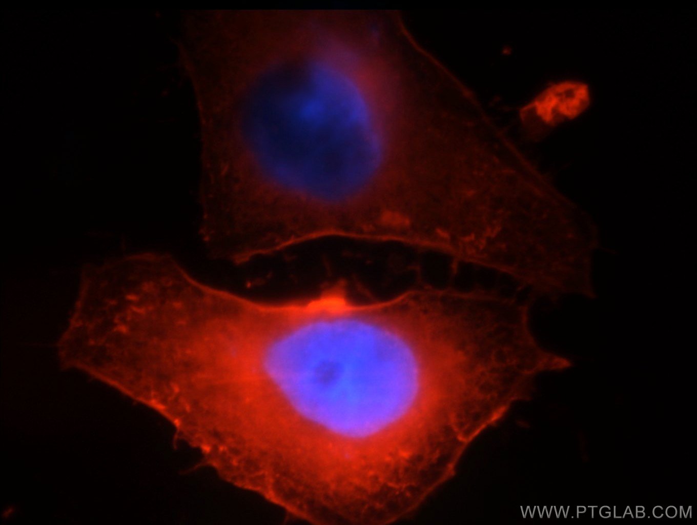 Beta Actin Monoclonal antibody