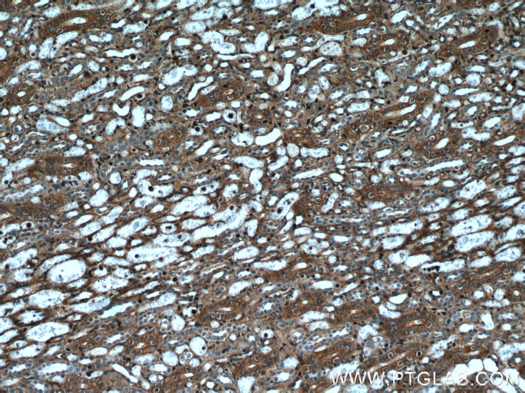 Immunohistochemistry (IHC) staining of human kidney tissue using Beta Actin Monoclonal antibody (66009-1-Ig)