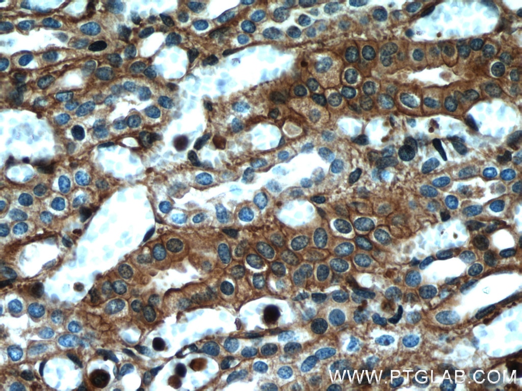 Immunohistochemistry (IHC) staining of human kidney tissue using Beta Actin Monoclonal antibody (66009-1-Ig)