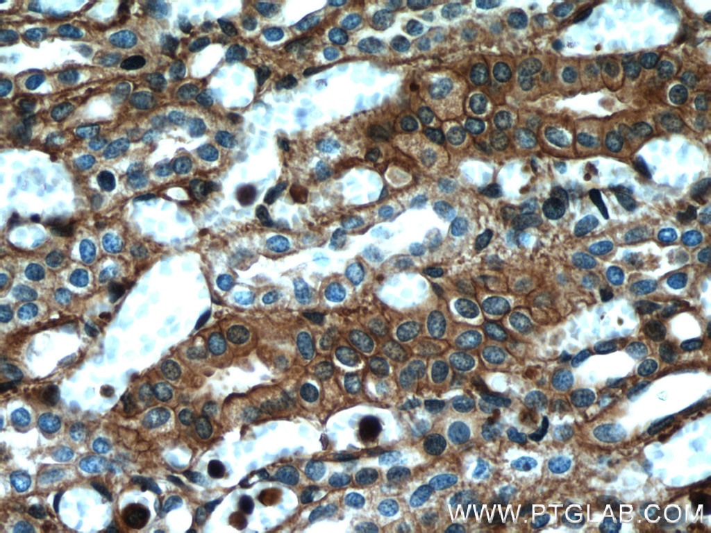 IHC staining of human kidney using 66009-1-Ig