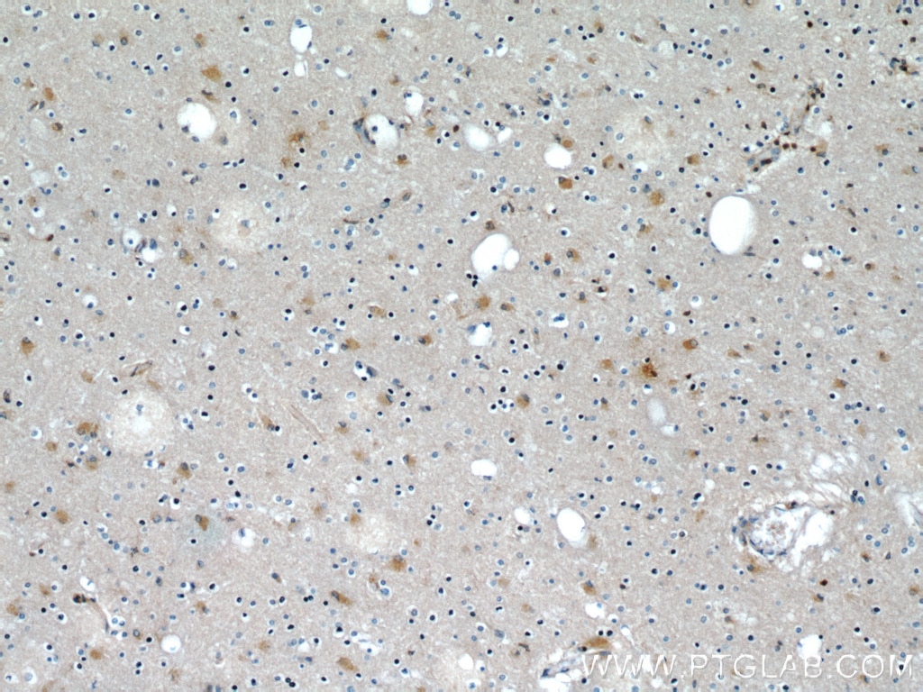 Immunohistochemistry (IHC) staining of human brain tissue using Beta Actin Monoclonal antibody (66009-1-Ig)