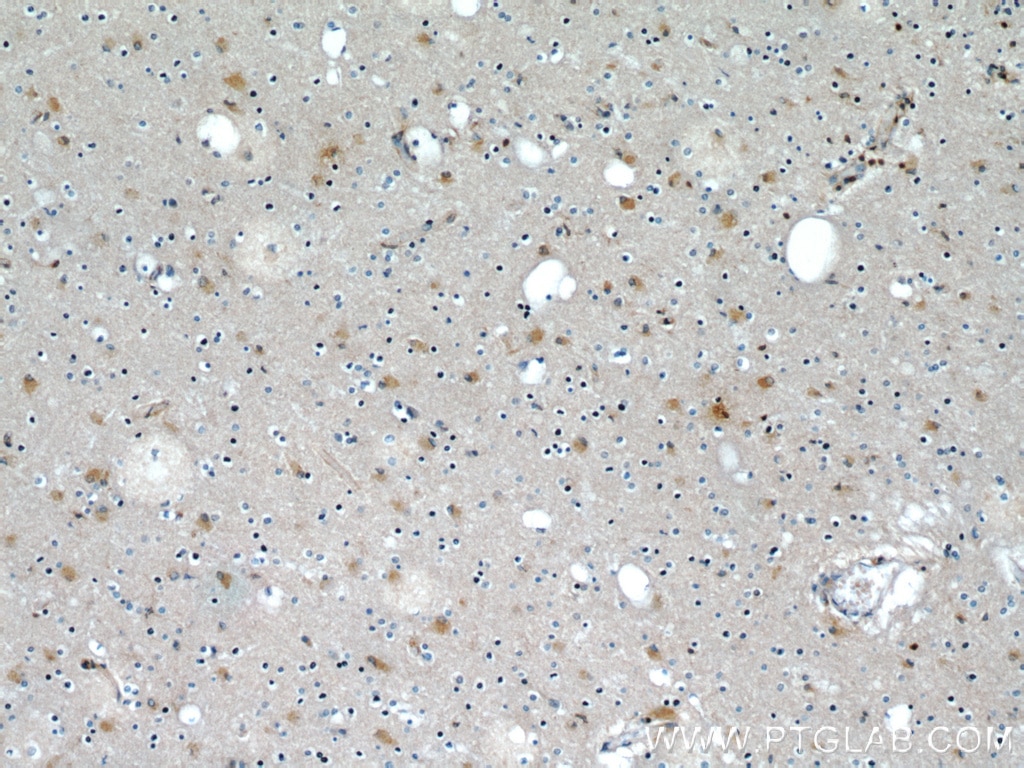 IHC staining of human brain using 66009-1-Ig