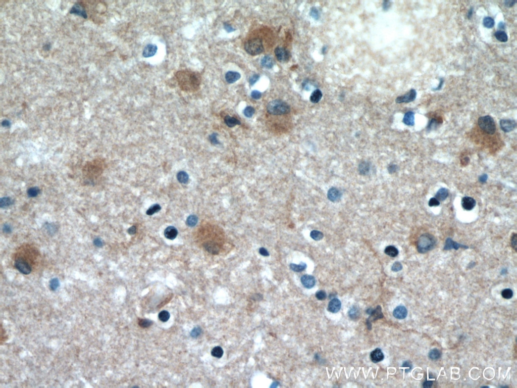 Immunohistochemistry (IHC) staining of human brain tissue using Beta Actin Monoclonal antibody (66009-1-Ig)