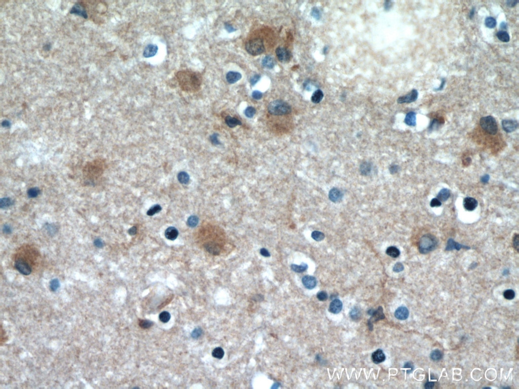 IHC staining of human brain using 66009-1-Ig