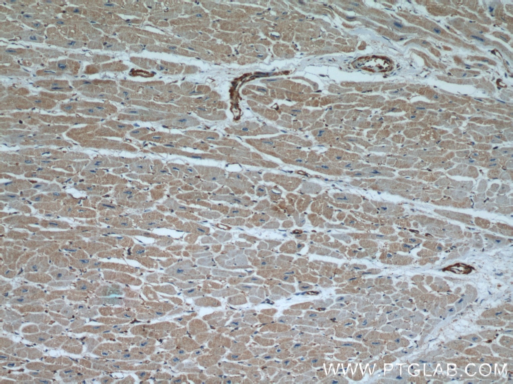 IHC staining of human heart using 66009-1-Ig