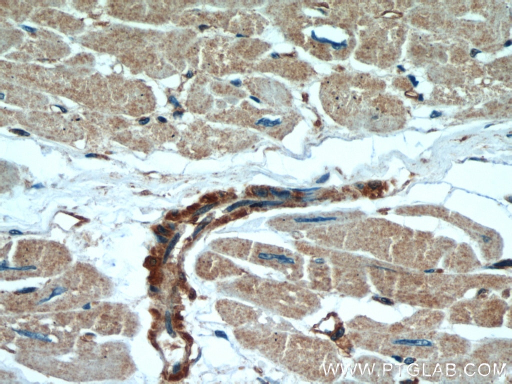 IHC staining of human heart using 66009-1-Ig