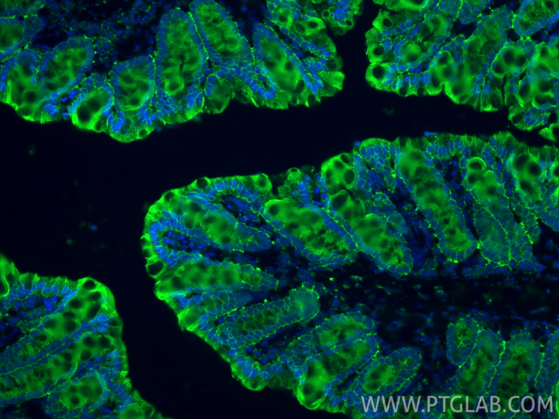 Immunofluorescent analysis of (4% PFA) fixed paraffin-embedded mouse colon tissue using Pan-Keratin (TypeⅡ) antibody (86370-1-RR, Clone: 251040F7 ) at dilution of 1:400 and CoraLite®488-Conjugated Goat Anti-Rabbit IgG(H+L) (SA00013-2). Heat mediated antigen retrieval with Tris-EDTA buffer (pH 9.0). Immunofluorescence (IF) / fluorescent staining of mouse colon tissue using Pan-Keratin (TypeⅡ) Recombinant monoclonal antibod (86370-1-RR)