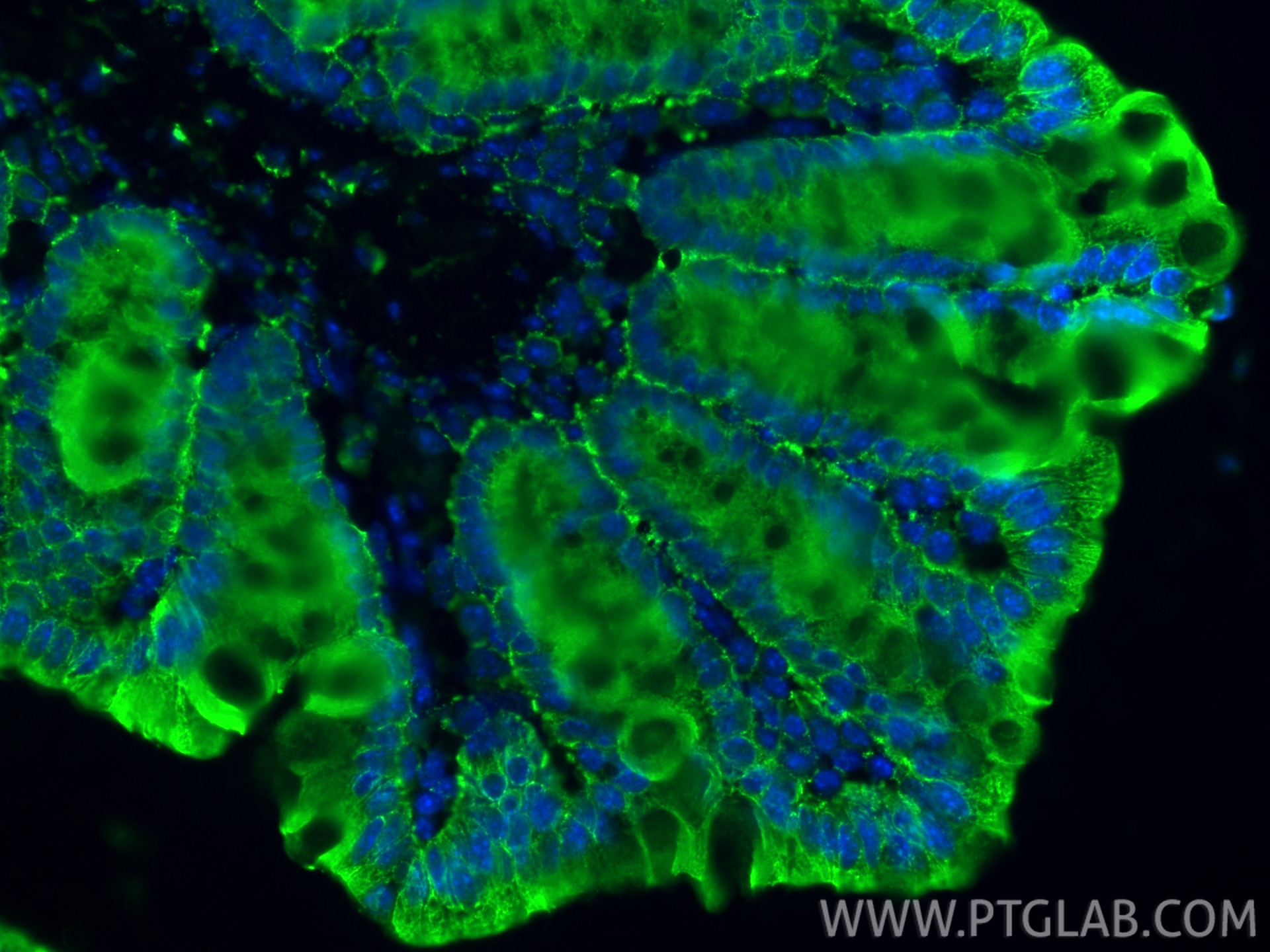 Immunofluorescent analysis of (4% PFA) fixed paraffin-embedded mouse colon tissue using Pan-Keratin (TypeⅡ) antibody (86370-1-RR, Clone: 251040F7 ) at dilution of 1:400 and CoraLite®488-Conjugated Goat Anti-Rabbit IgG(H+L) (SA00013-2). Heat mediated antigen retrieval with Tris-EDTA buffer (pH 9.0). Immunofluorescence (IF) / fluorescent staining of mouse colon tissue using Pan-Keratin (TypeⅡ) Recombinant monoclonal antibod (86370-1-RR)