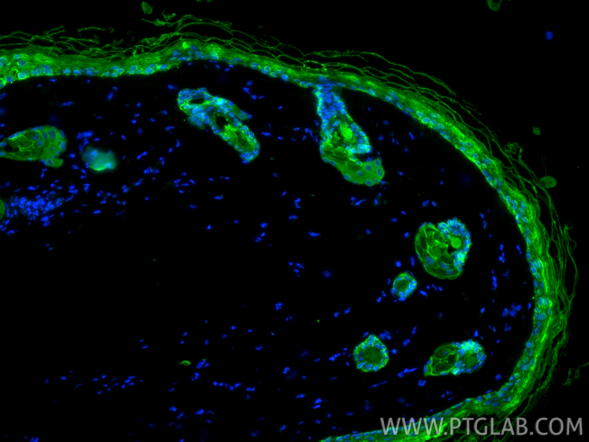 Immunofluorescence (IF) / fluorescent staining of mouse skin tissue using Pan-Keratin (TypeⅡ) Recombinant monoclonal antibod (86370-1-RR)