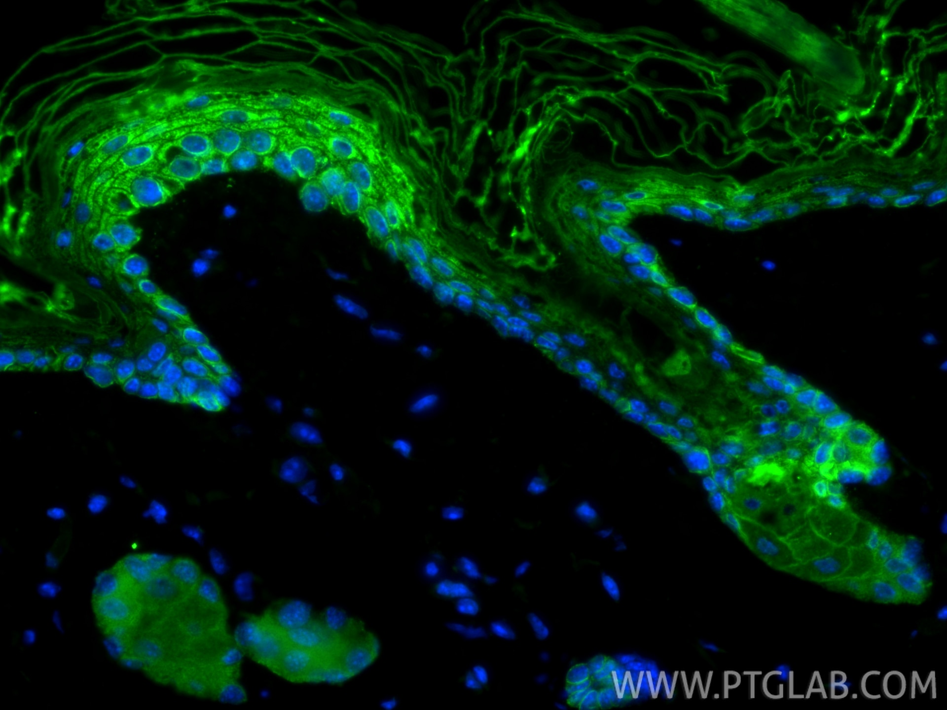 Immunofluorescence (IF) / fluorescent staining of mouse skin tissue using Pan-Keratin (TypeⅡ) Recombinant monoclonal antibod (86370-1-RR)