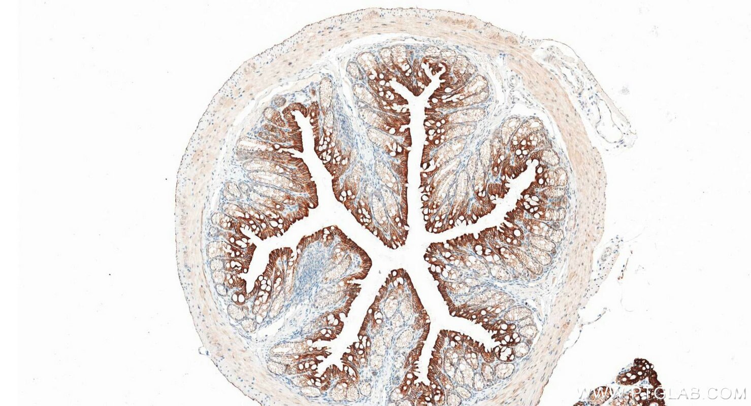 Immunohistochemistry (IHC) staining of mouse colon tissue using Pan-Keratin (TypeⅡ) Recombinant monoclonal antibod (86370-1-RR)