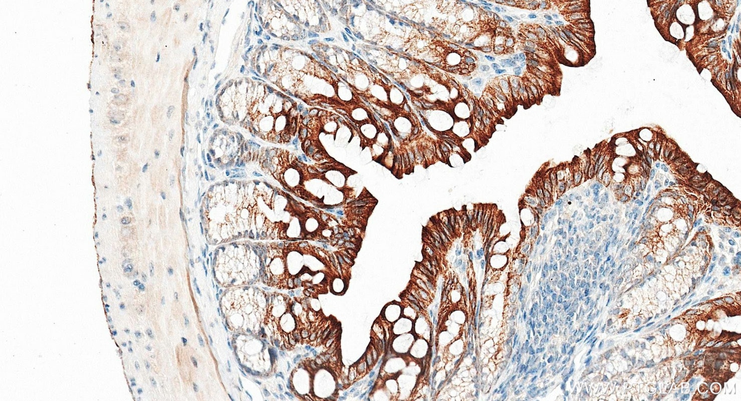 Immunohistochemistry (IHC) staining of mouse colon tissue using Pan-Keratin (TypeⅡ) Recombinant monoclonal antibod (86370-1-RR)