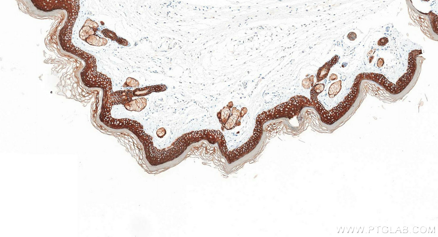 Immunohistochemistry (IHC) staining of mouse skin tissue using Pan-Keratin (TypeⅡ) Recombinant monoclonal antibod (86370-1-RR)