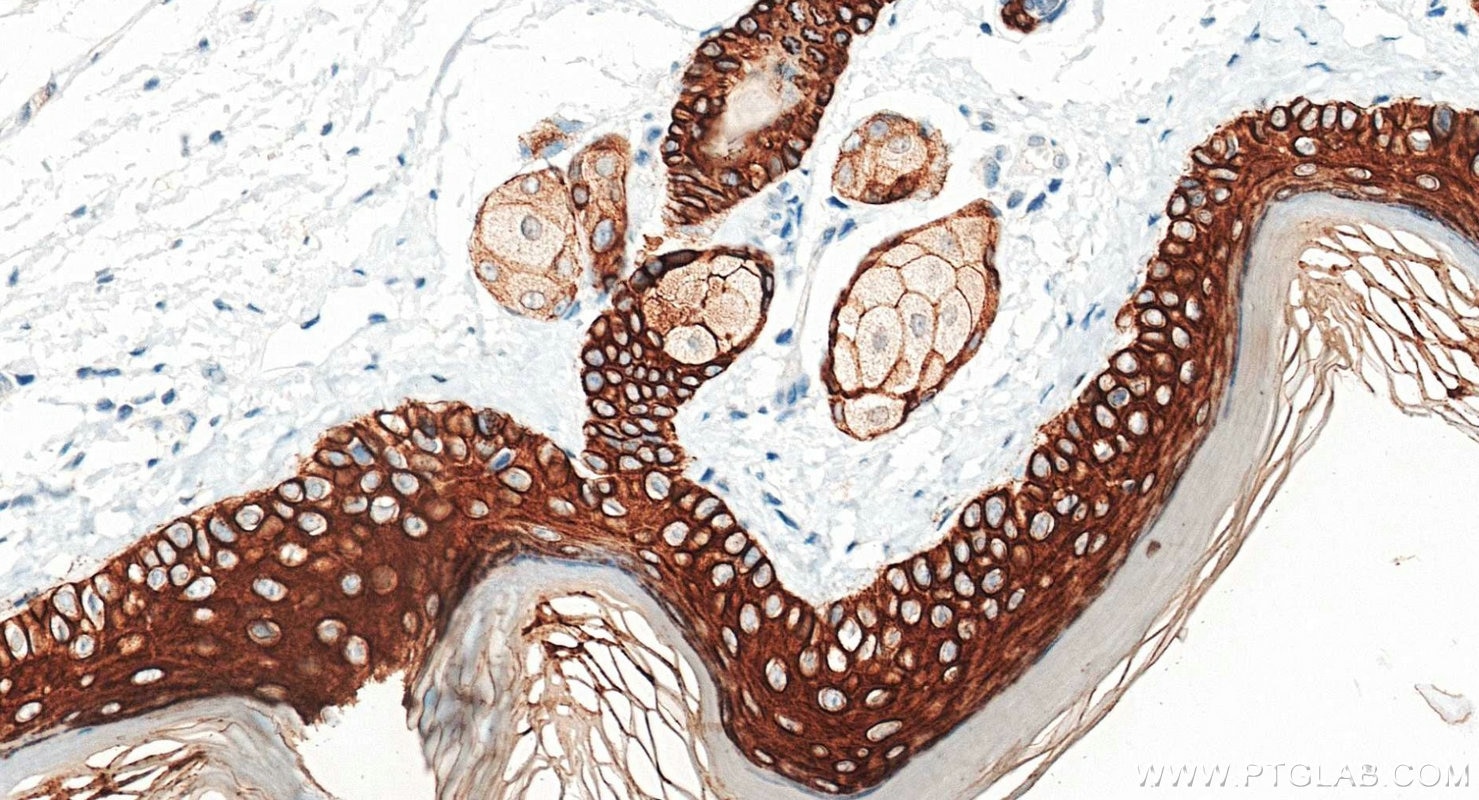 Immunohistochemistry (IHC) staining of mouse skin tissue using Pan-Keratin (TypeⅡ) Recombinant monoclonal antibod (86370-1-RR)