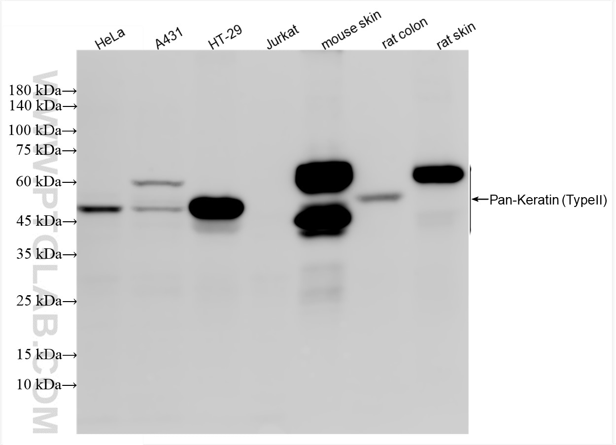 Western Blot (WB) analysis of various lysates using Pan-Keratin (TypeⅡ) Recombinant antibody (86370-1-RR)