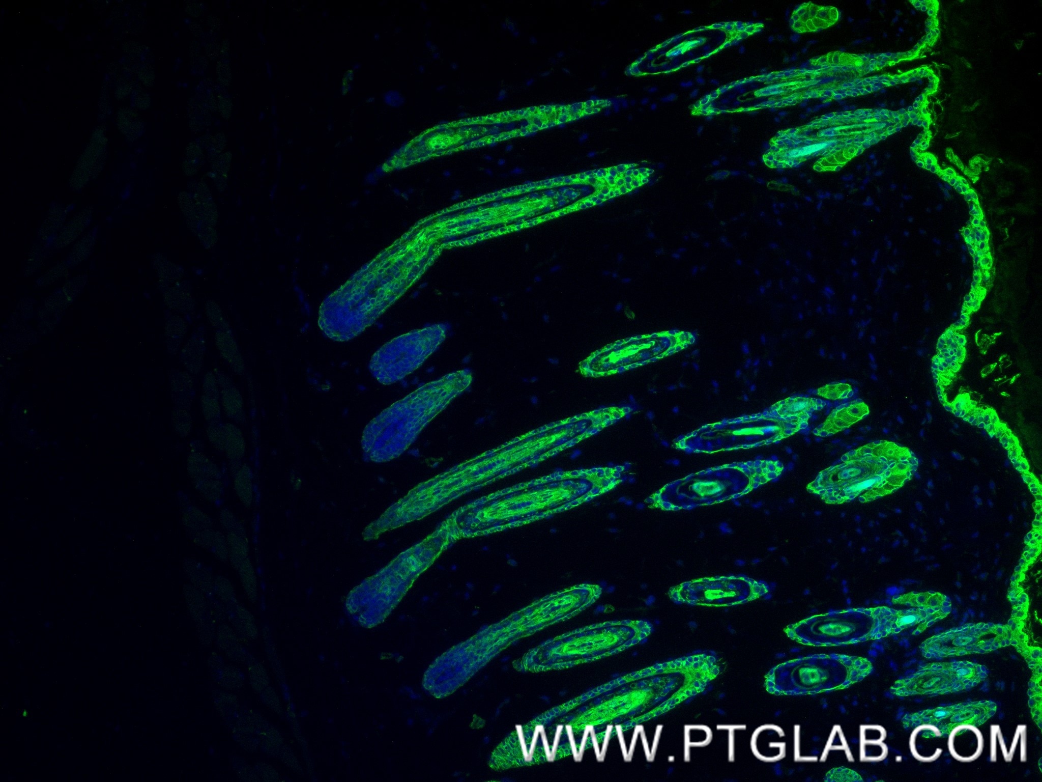 Immunofluorescent analysis of (4% PFA) fixed paraffin-embedded mouse skin tissue using Pan-Keratin (Type I) antibody (86238-2-RR, Clone: 251039C1 ) at dilution of 1:400 and CoraLite®488-Conjugated Goat Anti-Rabbit IgG(H+L) (SA00013-2). Heat mediated antigen retrieval with Tris-EDTA buffer (pH 9.0). Immunofluorescence (IF) / fluorescent staining of mouse skin tissue using Pan-Keratin (Type I) Recombinant monoclonal antibo (86238-2-RR)