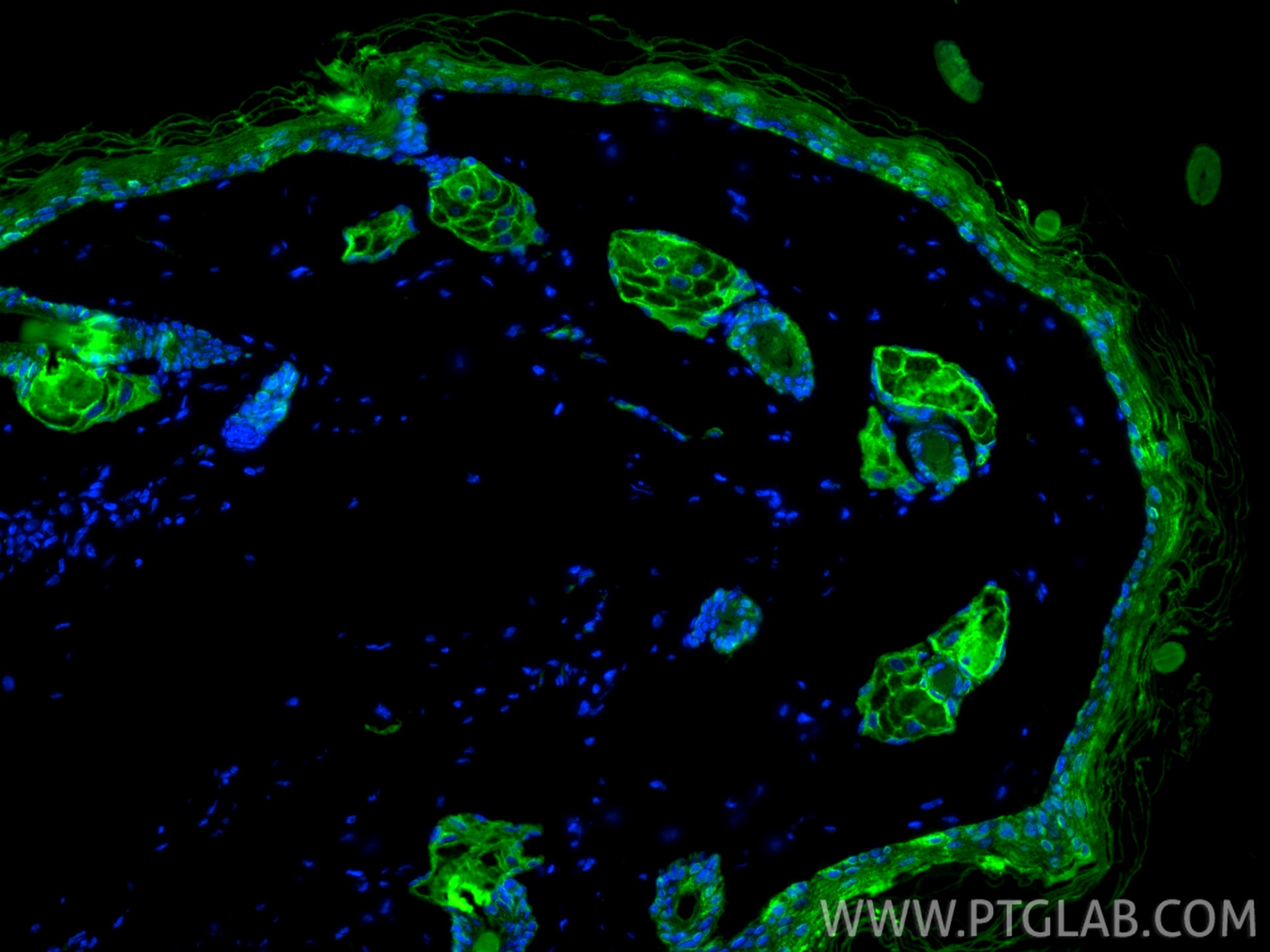 Immunofluorescence (IF) / fluorescent staining of mouse skin tissue using Pan-Keratin (Type I) Recombinant monoclonal antibo (86238-2-RR)