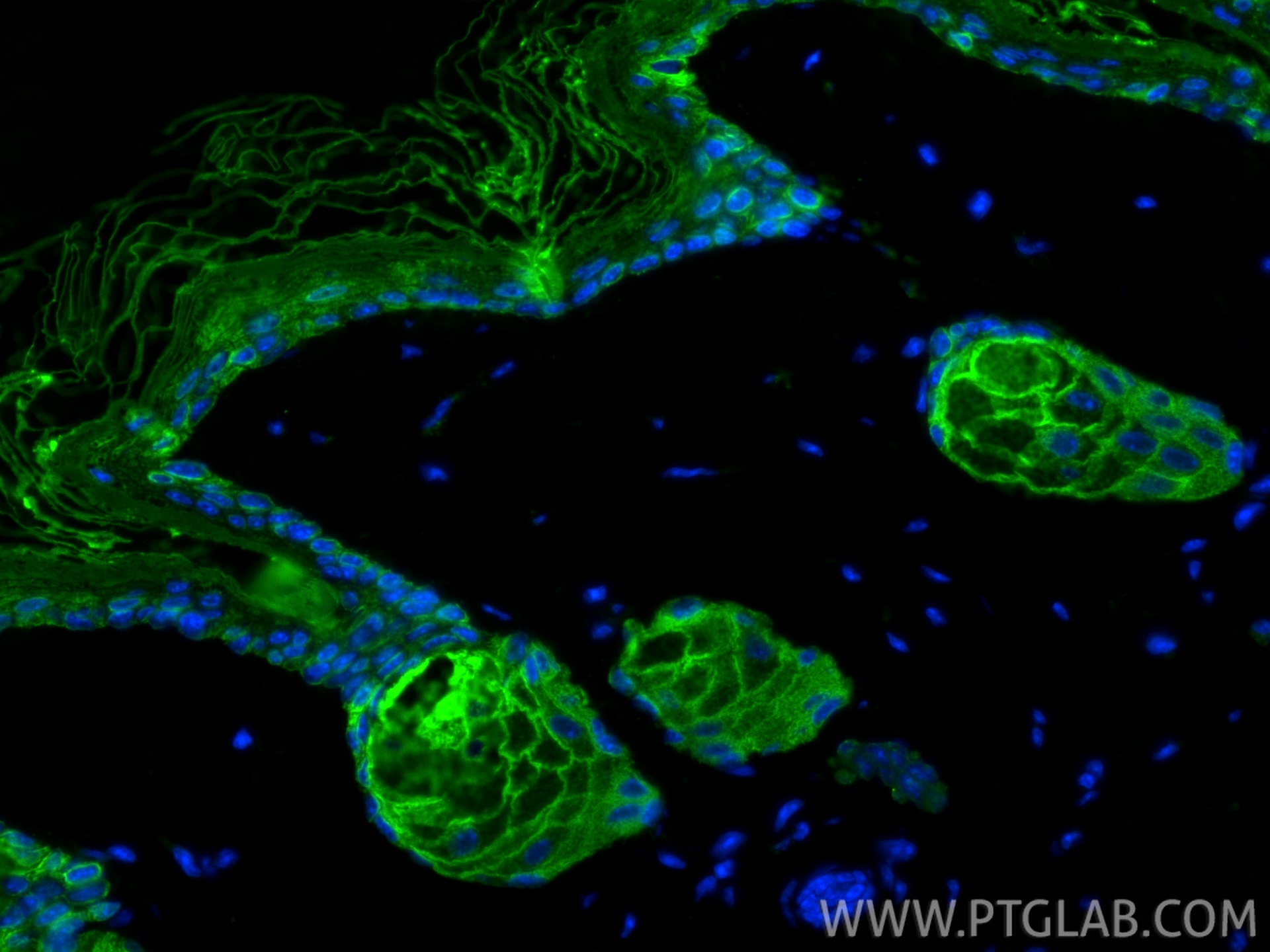 Immunofluorescence (IF) / fluorescent staining of mouse skin tissue using Pan-Keratin (Type I) Recombinant monoclonal antibo (86238-2-RR)
