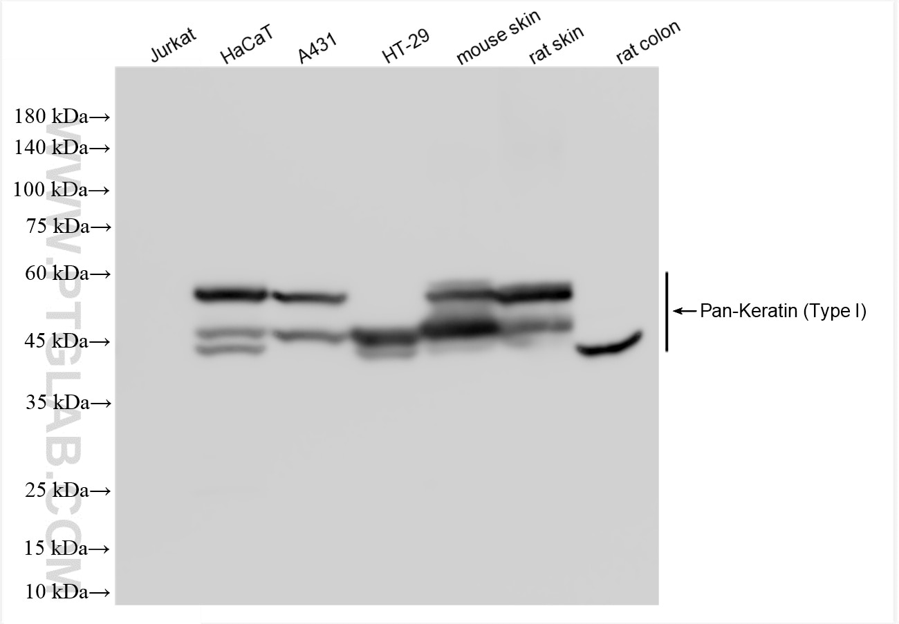 Various lysates were subjected to SDS PAGE followed by western blot with 86238-2-RR (Pan-Keratin (Type I) antibody) at dilution of 1:30000 incubated at room temperature for 1.5 hours. Western Blot (WB) analysis of various lysates using Pan-Keratin (Type I) Recombinant antibody (86238-2-RR)