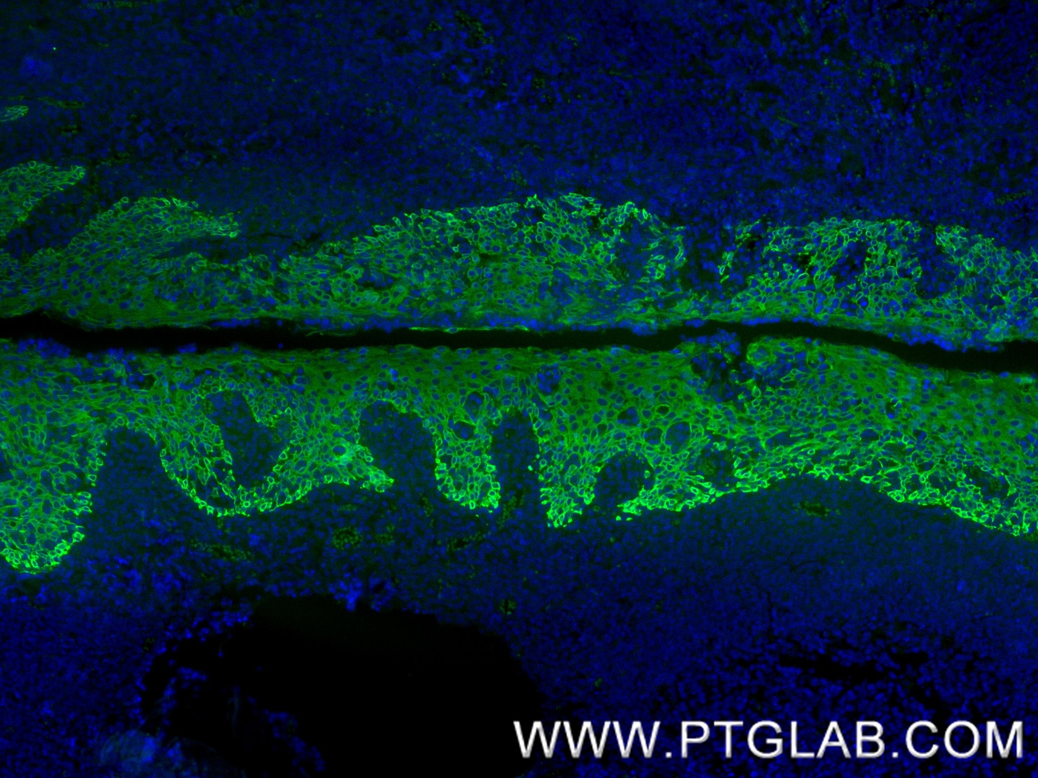 Immunofluorescence (IF) / fluorescent staining of human tonsil tissue using Pan-Keratin (Type I) Recombinant monoclonal antibo (86238-5-RR)